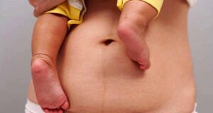 सिजेरियन डिलीवरी का बढ़ता चलन,मेडिकल जरूरत या बड़ा बिज़नेस?