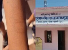 CG के स्कूल में छात्र ने एक दर्जन सहपाठियों को काटा, स्वास्थ्य विभाग की टीम पहुंची जांच में