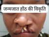 सफल सर्जरी से भीमे हेमला के चेहरे पर लौटी मुस्कान