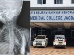 बस्तर में बच्ची के गले में फंसा सेफ्टी पिन, डॉक्टरों ने दूरबीन पद्धति से निकालकर बचाई जान